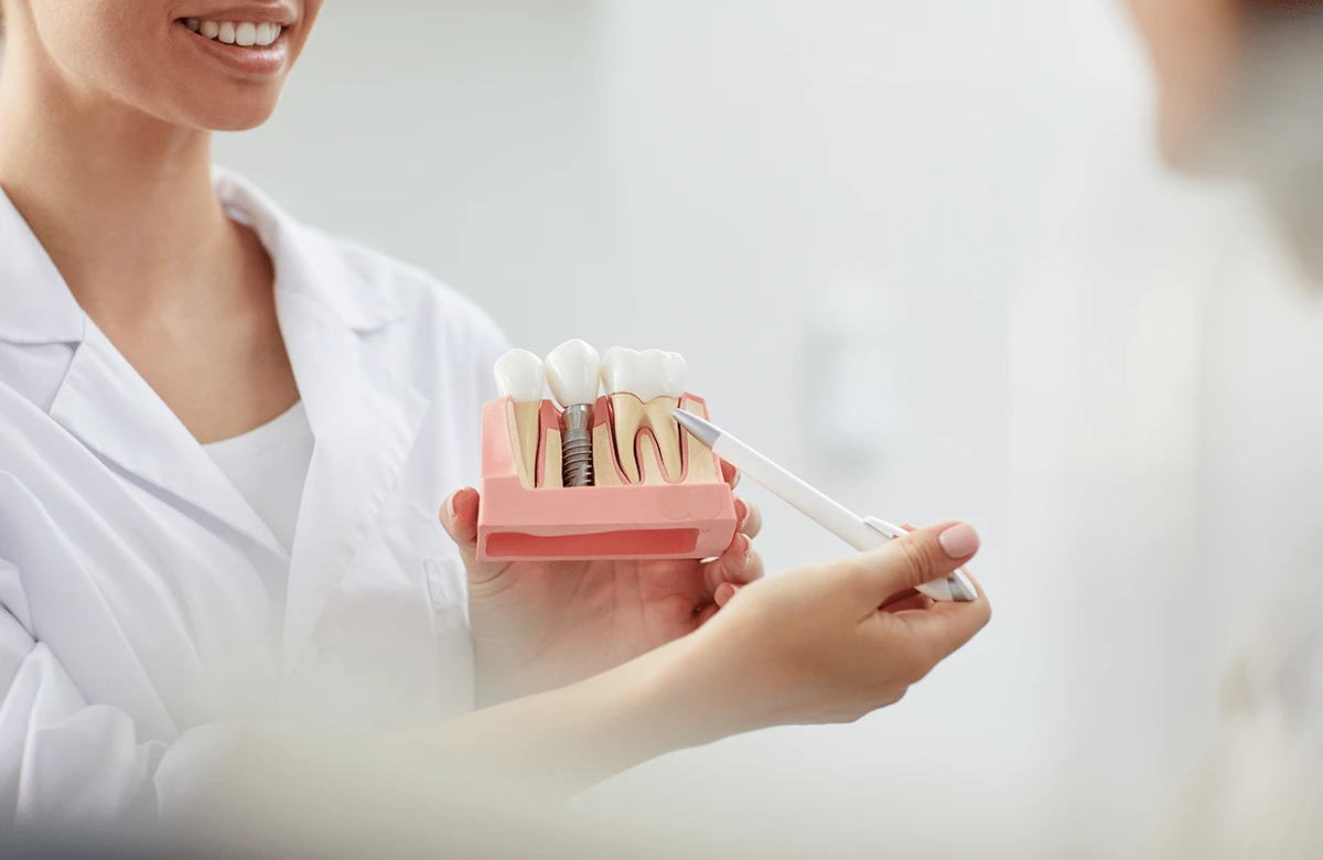 Dentist explaining a single dental implant model to a patient at Ardent Smile Clinic